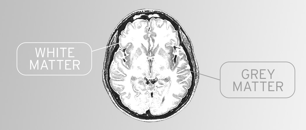 Diagram showing the relationship between grey matter and white matter in the brain during neuroplasticity processes